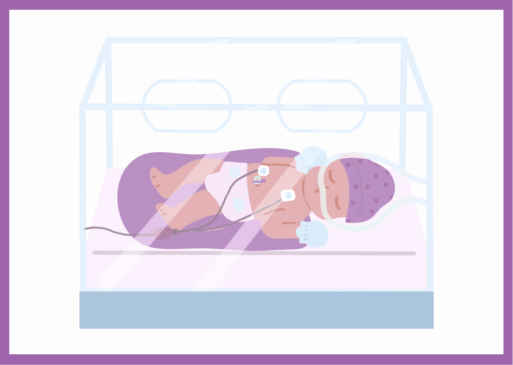 Premature Baby