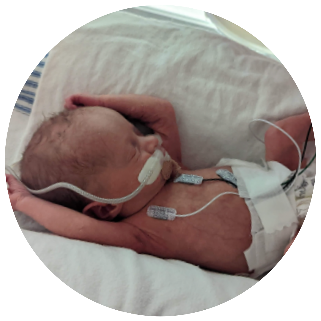 Prematurity Facts