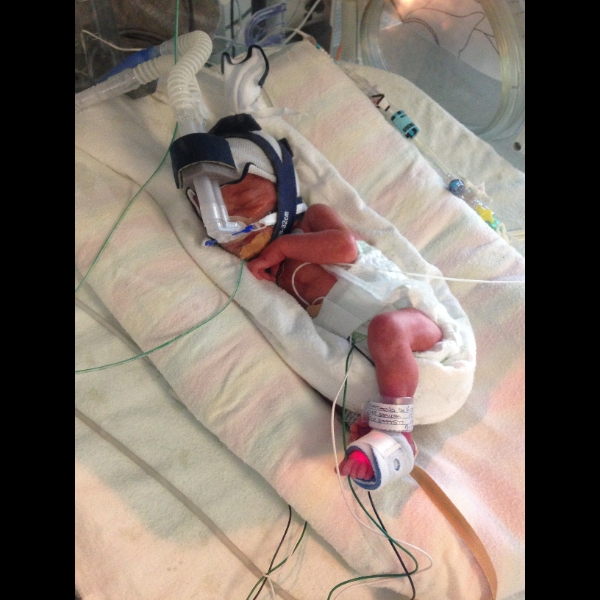 Running for Premature Babies - Allan Aitkenhead